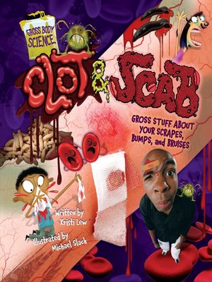 cover image of Clot & Scab